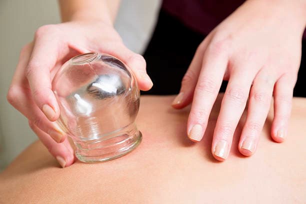Cupping Therapy