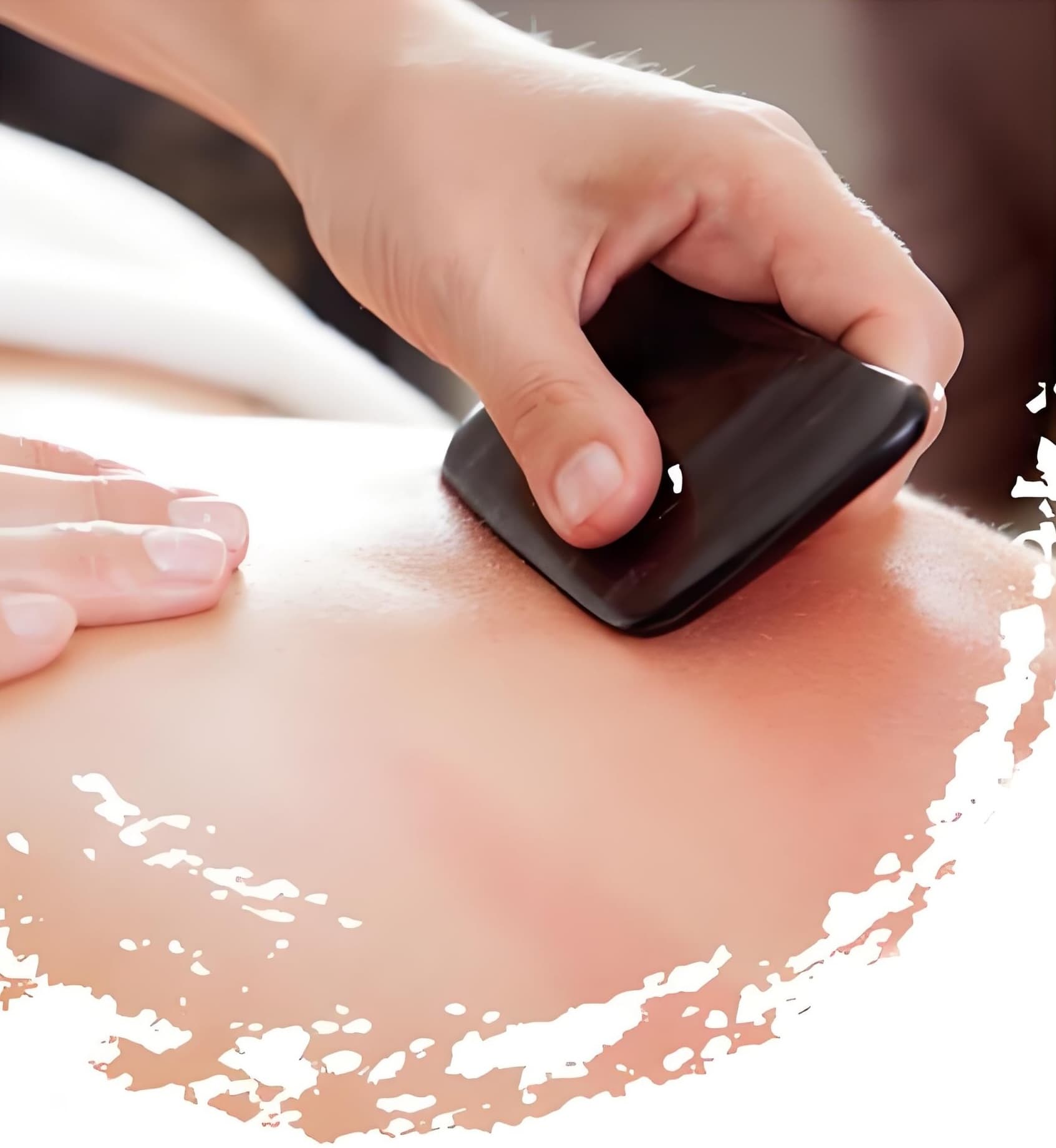 Special Needling